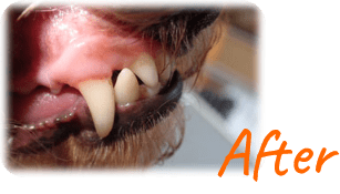歯磨き後の歯の写真